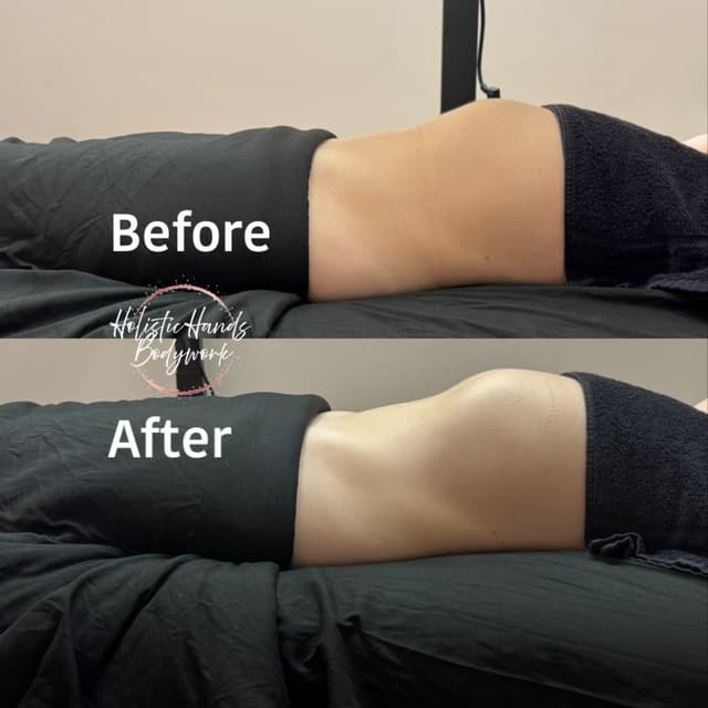 Lymphatic Extended Body Membership at Holistic Hands Bodywork LLC in Las Vegas, NV